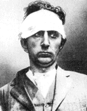 Erich Muenter photographed after his arrest in 1915